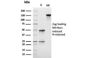 SDS-PAGE Analysis Purified Monospecific Mouse Monoclonal Antibody to LSP1 (LSP1/3042). (LSP1 anticorps  (AA 174-278))