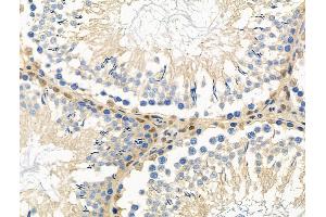 ABIN6264642 and ABIN6276374 at 1/100 staining Rat testis tissue by IHC-P. (Retinoic Acid Receptor alpha anticorps  (N-Term))