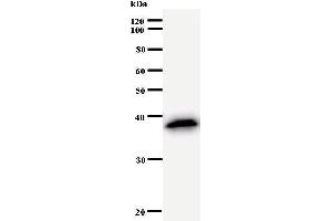 Western Blotting (WB) image for anti-Activating Transcription Factor 2 (ATF2) antibody (ABIN930912) (ATF2 anticorps)