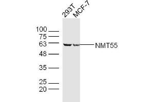 Lane 1: 293T lysates Lane 2: MCF-7 lysates probed with NMT55 Polyclonal Antibody, Unconjugated  at 1:300 dilution and 4˚C overnight incubation. (NONO anticorps  (AA 21-120))
