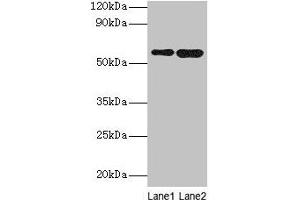 Western blot All lanes: SCP2 antibody at 2 μg/mL Lane 1: A549 whole cell lysate Lane 2: MCF-7 whole cell lysate Secondary Goat polyclonal to rabbit IgG at 1/10000 dilution Predicted band size: 59, 16, 35, 51, 7, 55, 57 kDa Observed band size: 59 kDa (SCP2 anticorps  (AA 1-143))