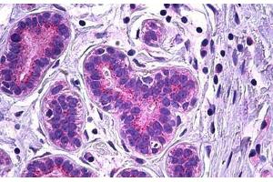 Human Breast, Epithelium: Formalin-Fixed, Paraffin-Embedded (FFPE) (VPS35 anticorps  (AA 783-796))