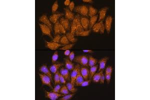 Immunofluorescence analysis of HeLa cells using V1E1 Rabbit pAb (ABIN1678795, ABIN3018056, ABIN3018057 and ABIN6220346) at dilution of 1:100. (ATP6V1E1 anticorps  (AA 77-226))