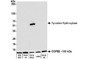 Western Blotting (WB) image for anti-Tyrosine Hydroxylase (TH) (AA 450-500) antibody (ABIN7449433) (Recombinant Tyrosine Hydroxylase anticorps  (AA 450-500))