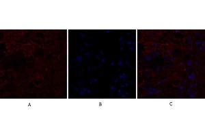 Immunofluorescence analysis of human breast cancer tissue. (IL-8 anticorps  (C-Term))