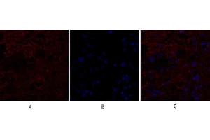 Immunofluorescence analysis of human breast cancer tissue. (IL-8 anticorps  (C-Term))