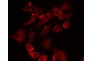 ABIN6274452 staining RAW264. (BRI3BP anticorps  (N-Term))