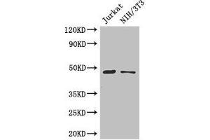 Western Blot Positive WB detected in: Jurkat whole cell lysate, NIH/3T3 whole cell lysate All lanes: SGK1 antibody at 3 μg/mL Secondary Goat polyclonal to rabbit IgG at 1/50000 dilution Predicted band size: 49, 60, 51, 48, 53 kDa Observed band size: 49 kDa (SGK1 anticorps  (AA 247-406))