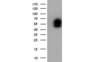Image no. 2 for anti-LIM Homeobox 1 (LHX1) (AA 100-362) antibody (ABIN1490804) (LHX1 anticorps  (AA 100-362))