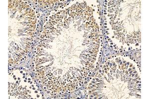 ABIN6260157 and ABIN6277857 at 1/100 staining rat testis tissue by IHC-P. (AurB/C anticorps  (N-Term))