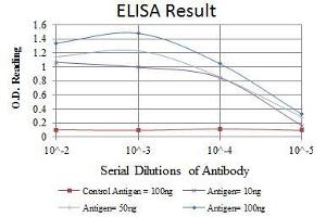 Red: Control Antigen (100 ng), Purple: Antigen (10 ng), Green: Antigen (50 ng), Blue: Antigen (100 ng), (ATM anticorps)