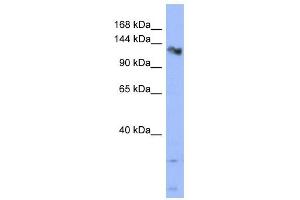 CHERP antibody used at 1 ug/ml to detect target protein. (CHERP anticorps  (Middle Region))