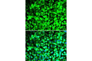 Immunofluorescence analysis of U2OS cells using EIF5 antibody (ABIN5973954). (EIF5 anticorps)