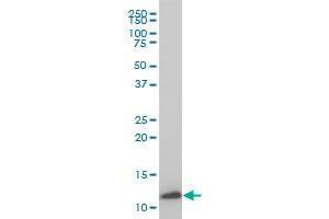 TIMM9 monoclonal antibody (M01), clone 1D6 Western Blot analysis of TIMM9 expression in IMR-32 .