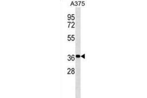 Western Blotting (WB) image for anti-Non-SMC Element 1 Homolog (NSMCE1) antibody (ABIN3000163) (NSMCE1 anticorps)
