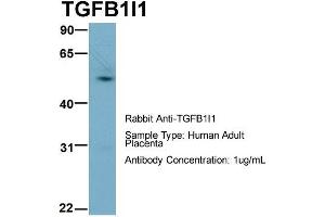 Host:  Rabbit  Target Name:  TGFB1I1  Sample Type:  Human Adult Placenta  Antibody Dilution:  1.