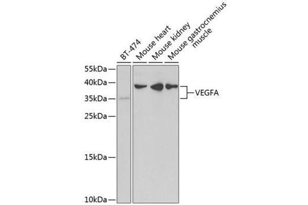 VEGFA 抗体  (AA 1-147)