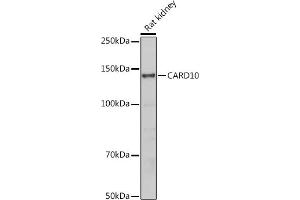 Western blot analysis of extracts of Rat kidney, using C antibody (ABIN6127549, ABIN6137937, ABIN6137938 and ABIN6223226) at 1:500 dilution. (CARD10 anticorps  (AA 863-1032))
