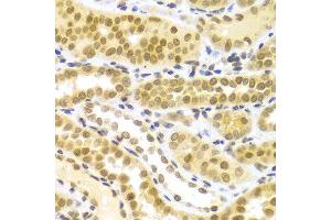 Immunohistochemistry of paraffin-embedded Human kidney using ELAVL1 antibody at dilution of 1:100 (x400 lens).