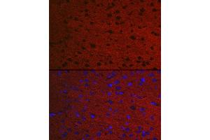Immunofluorescence analysis of Rat brain using RA antibody (ABIN7269809) at dilution of 1:50.