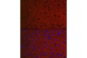 Immunofluorescence analysis of Rat brain using RA antibody (ABIN7269809) at dilution of 1:50. (RAB3A anticorps  (AA 100-200))