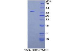 SDS-PAGE analysis of Mouse Sirtuin 6 Protein.