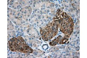 Immunohistochemical staining of paraffin-embedded Kidney tissue using anti-TUBA8 mouse monoclonal antibody. (TUBA8 anticorps)