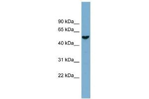 FAM83E antibody used at 1 ug/ml to detect target protein.