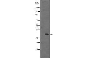 Western blot analysis of IGFBPL1 expression in Human fetal liver lysate ,The lane on the left is treated with the antigen-specific peptide. (IGFBPL1 anticorps  (Internal Region))
