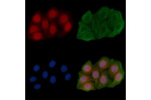 ABIN6261789 and ABIN6266775 staining Hela cells(45 min of heat-shock) by IF/ICC. (FOXH1 anticorps  (Internal Region))
