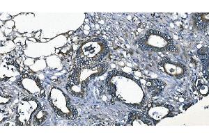 IHC analysis of EEF2/Elongation factor 2 using anti-EEF2/Elongation factor 2 antibody (ABIN7603142). (EEF2 anticorps  (N-Term))