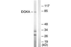 Western blot analysis of extracts from Jurkat cells, using DGKA Antibody. (DGKA anticorps  (AA 304-353))