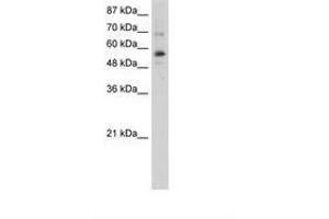 Image no. 1 for anti-Zinc Finger Protein 71 (ZNF71) (N-Term) antibody (ABIN6736258) (ZNF71 anticorps  (N-Term))