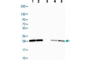 Western blot analysis of Lane 1: Human cell line RT-4 Lane 2: Human cell line U-251MG sp Lane 3: Human plasma (IgG/HSA depleted) Lane 4: Human liver tissue Lane 5: Human tonsil tissue with RBL1 polyclonal antibody  at 1:250-1:500 dilution. (p107 anticorps)