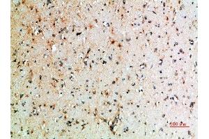 Immunohistochemical analysis of paraffin-embedded human-brain, antibody was diluted at 1:200