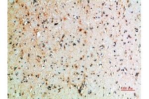 Immunohistochemical analysis of paraffin-embedded human-brain, antibody was diluted at 1:200 (CTLA4 anticorps  (AA 41-90))