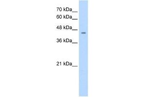 WB Suggested Anti-NR1I3 Antibody Titration:  1. (NR1I3 anticorps  (C-Term))
