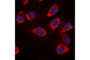 Immunofluorescent analysis of Alpha-adducin staining in HeLa cells.