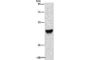 Western blot analysis of Human esophagus cancer tissue, using KRT13 Polyclonal Antibody at dilution of 1:500
