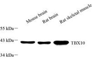 Western blot analysis of TBX10 (ABIN7075814),at dilution of 1: 1000,Lane 1: Mouse brain tissue lysate,Lane 2: Rat brain tissue lysate,Lane 3: Rat skeletal muscle tissue lysate (T-Box 10 anticorps)