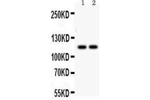 Western Blotting (WB) image for anti-ATPase, Ca++ Transporting, Ubiquitous (ATP2A3) (AA 1-30), (N-Term) antibody (ABIN3043794)