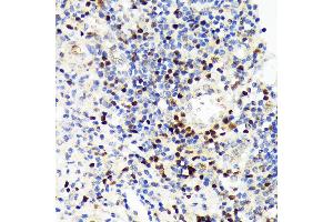 Immunohistochemistry of paraffin-embedded human appendix using P Rabbit mAb (ABIN7269154) at dilution of 1:100 (40x lens). (PAX5 anticorps)