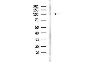 anti-Coiled-Coil Domain Containing 39 (CCDC39) antibody
