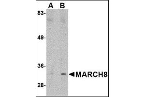 Western blot analysis of MARCH8 in HeLa cell lysate with MARCH8 antibody at (A) 0. (MARCH8 anticorps  (C-Term))