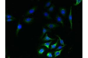 Immunofluorescent analysis of A549 cells using ABIN7170170 at dilution of 1:100 and Alexa Fluor 488-congugated AffiniPure Goat Anti-Rabbit IgG(H+L)