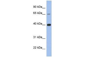 WB Suggested Anti-ESR1 Antibody Titration:  0. (Estrogen Receptor alpha anticorps  (C-Term))