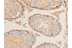 ABIN6267271 at 1/100 staining mouse testis tissue sections by IHC-P.