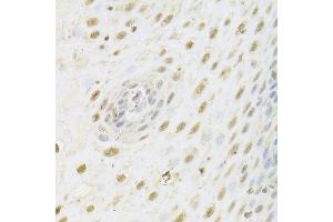 Immunohistochemistry of paraffin-embedded human esophagus using HDAC3 Antibody.