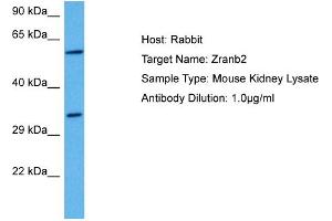 Host: Mouse Target Name: ZRANB2 Sample Tissue: Mouse Kidney Antibody Dilution: 1ug/ml (EIF5 anticorps  (C-Term))