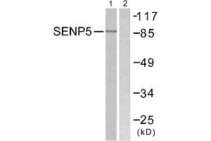 Western Blotting (WB) image for anti-SUMO1/sentrin Specific Peptidase 5 (SENP5) (C-Term) antibody (ABIN1848845) (SENP5 anticorps  (C-Term))